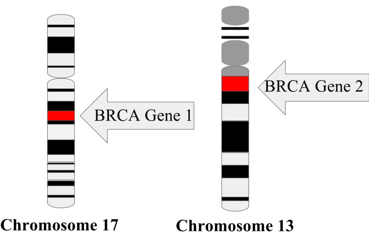 Gen BRCA là gì?