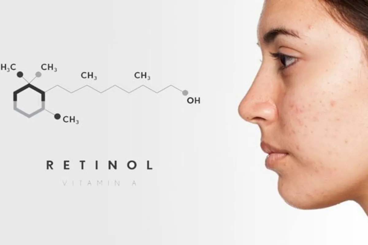 Một số tác dụng phụ có thể gặp khi dùng retinol