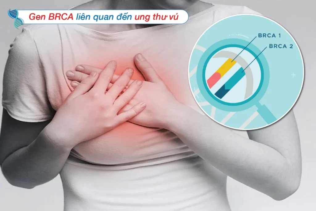 Đột biến gen BRCA: Nguyên nhân, nguy cơ và cách phòng ngừa